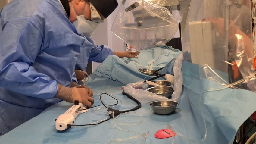 Русенска болница е пионер в страната по вид лечение на съдови стеснения на сърцето