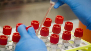 Регистрираха 5 новозаразени с COVID-19 и двама починали в област Русе